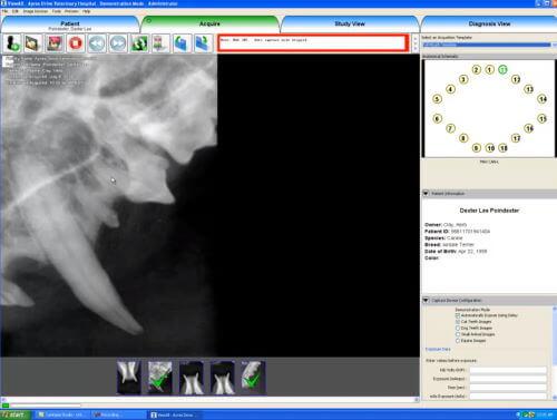 Dicom Software Acquire Screen Example with xrays