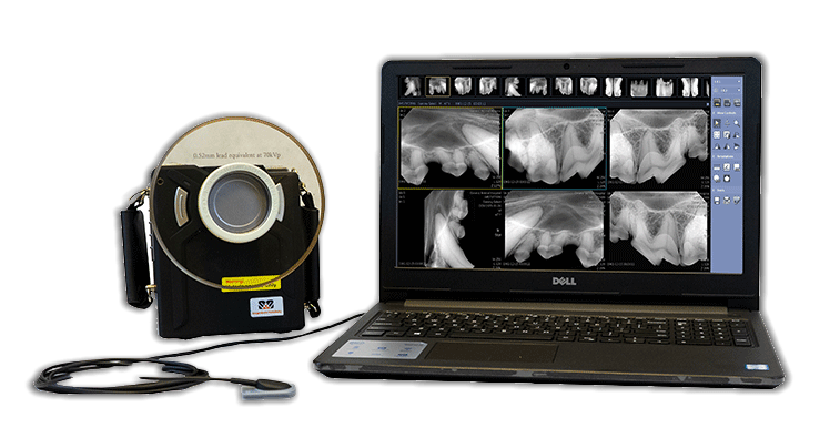flex digital x ray camera with laptop